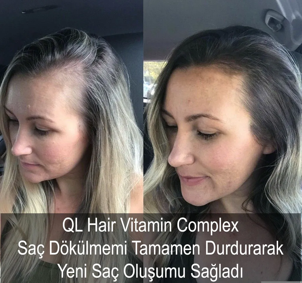 saç oluşumunu destekleme